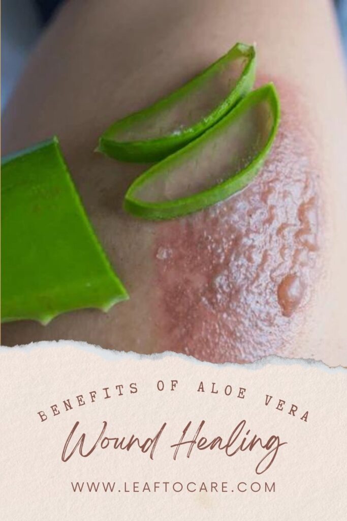 The Amazing Benefits of Aloe Vera